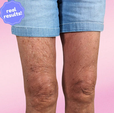 LiftAura™ — Instantly Tighten & Smooth Skin for All-Day Confidence