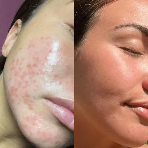 RadiantWave™ Mask — Unlock Your Skin’s Natural Glow with Effortless, Spa-Quality Care