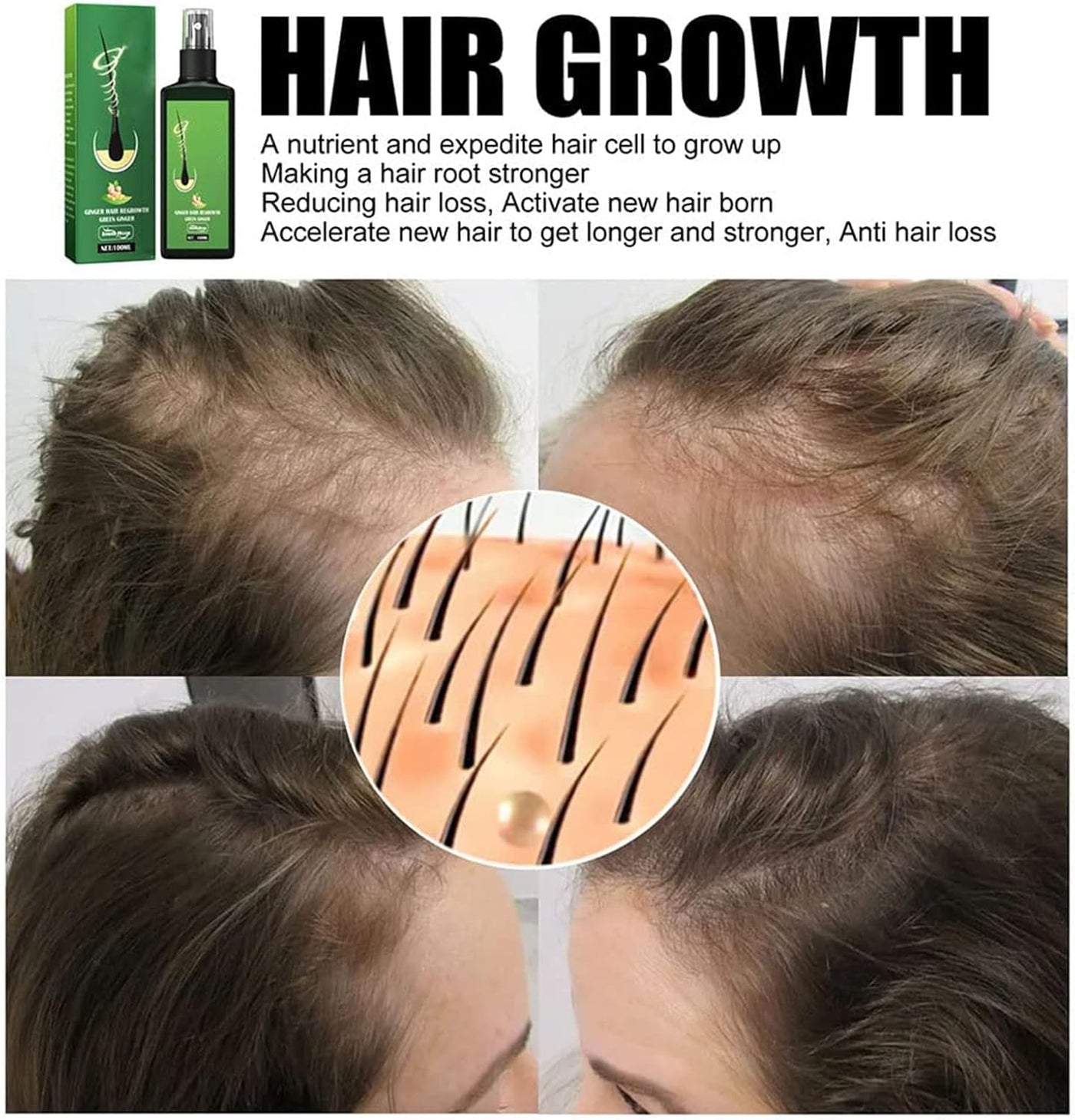 RevitaNest™ Hair Renewal Spray — Wake Up to Thicker, Stronger Hair Every Morning