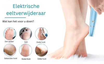 Softride™ — Glide Into Silky, Pain-Free Feet You’ll Proudly Show Off