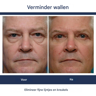 RevitaLift™ — Instantly Brighten and Refresh Tired Eyes for Ageless Confidence