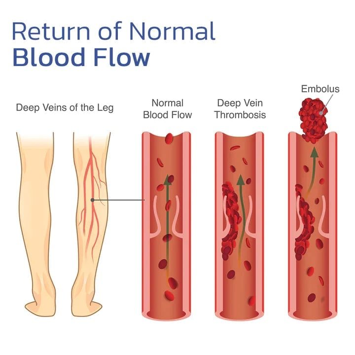 ThermaFlex™ — Feel the Soothing Heat That Frees Your Knees and Fuels Your Freedom