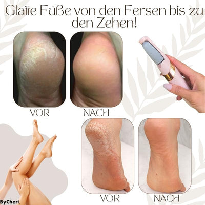 PediLuxe™ — Effortlessly Enjoy Soft, Smooth Feet That Boost Your Confidence