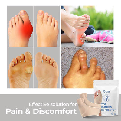 AlignTrek™ — Step Pain-Free and Watch Your Toes Realign in Comfort