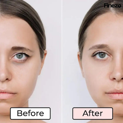 RevitaVue™ — Instantly Revive Tired Eyes and Reveal Youthful Radiance