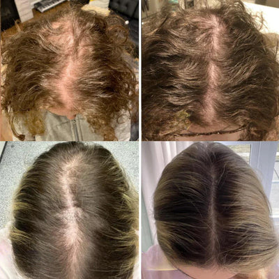 VitaMane™ — Awaken Your Scalp and Unleash a Fuller, Radiant Mane in Just 45 Days