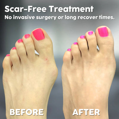 StrideEase™ — Walk Pain-Free with Gentle Toe Realignment You’ll Love Wearing