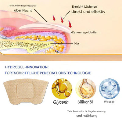 ClearNailX™ — Restore Your Nails’ Natural Beauty Quietly and Confidently All Day Long