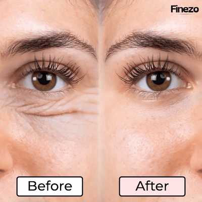 RevitaVue™ — Instantly Revive Tired Eyes and Reveal Youthful Radiance