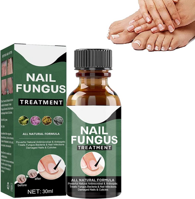 FungiFreeze™ — Unlock Clear, Healthy Nails and Step Out with Confidence