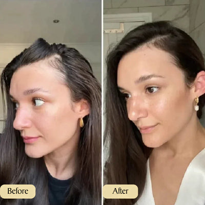 Veralyss™ Hair Elixir — Ignite Your Hair’s Natural Bounce and Brilliance in Just Weeks!