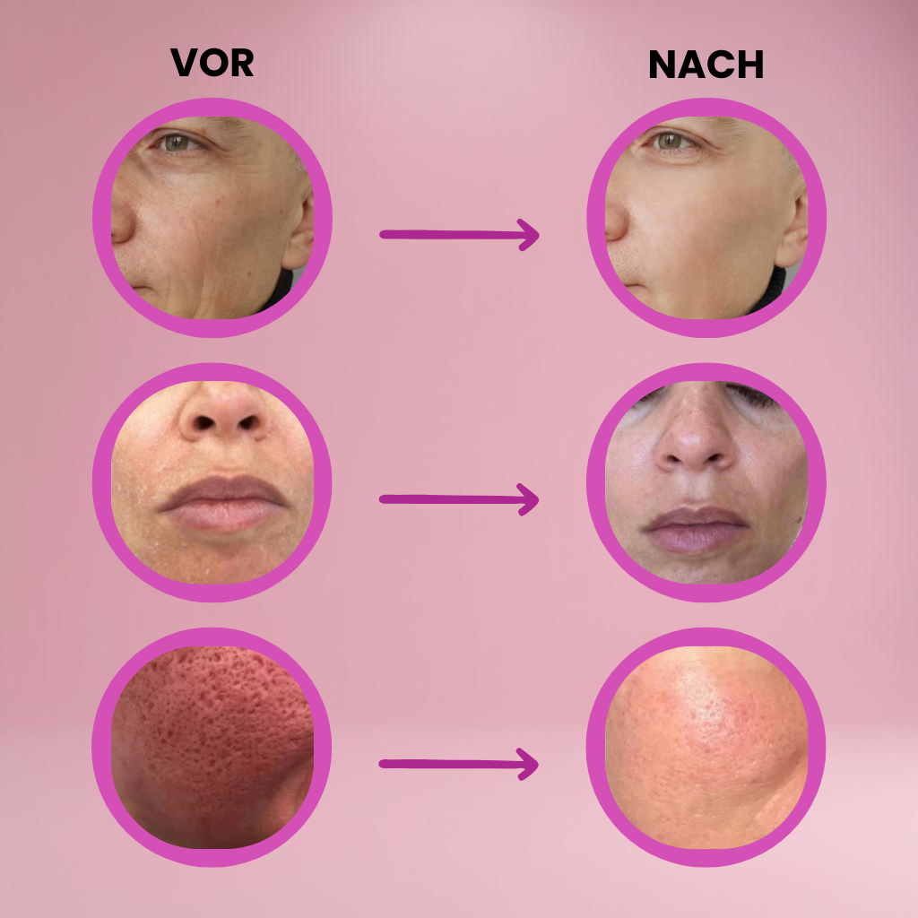 Velaré™ Balm — Smooth Away Wrinkles and Glow with Youthful Radiance Instantly