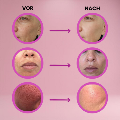 Velaré™ Balm — Smooth Away Wrinkles and Glow with Youthful Radiance Instantly