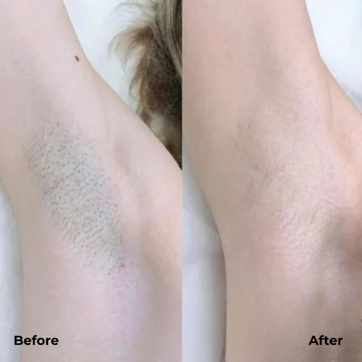 VeloraSmooth™ — Glide into Irresistibly Silky Legs Without a Single Irritation