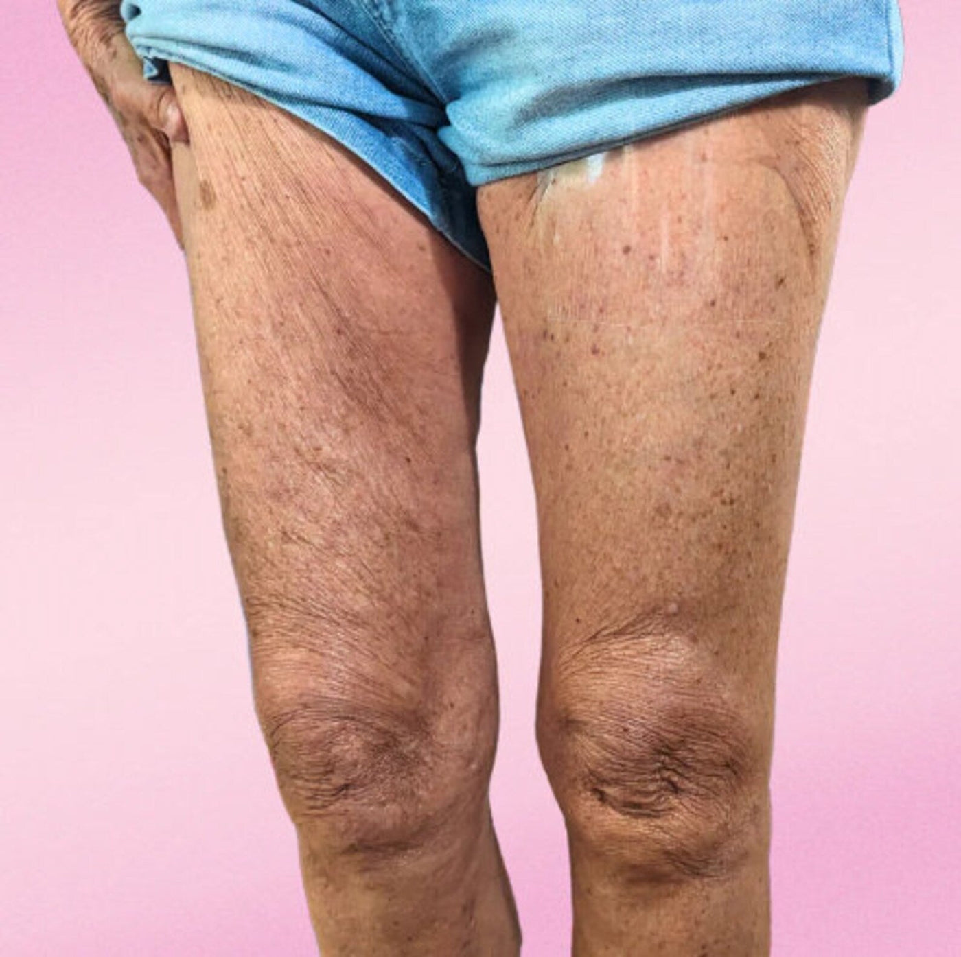 LiftAura™ — Instantly Tighten & Smooth Skin for All-Day Confidence