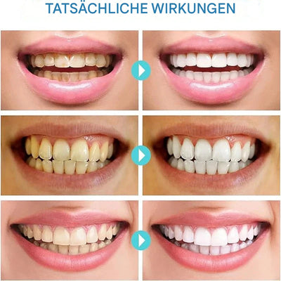 SmileRadiance™ — Reveal a Radiant Smile That Heals, Whitens, and Freshens Instantly