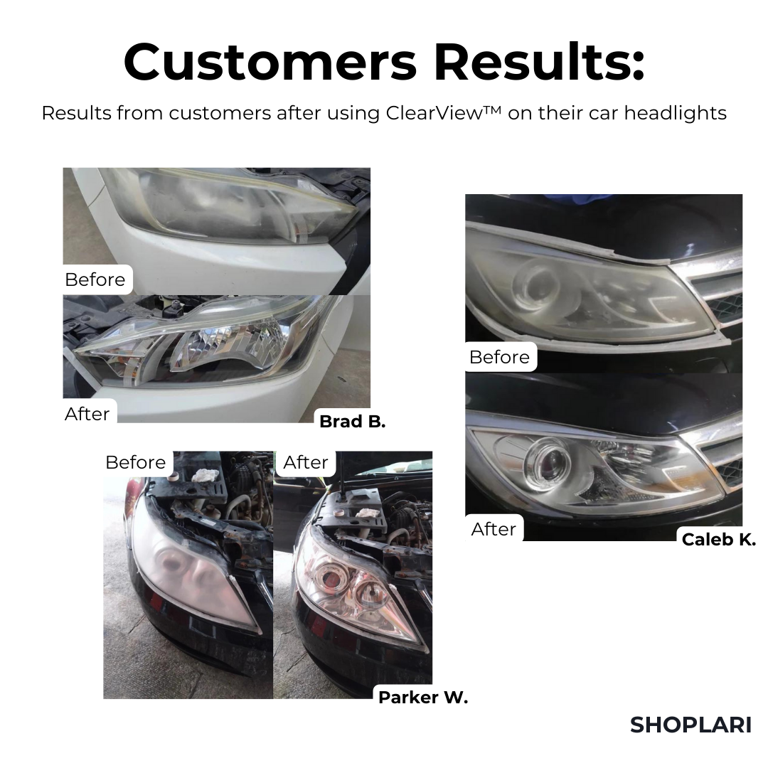 RadiantBeam™ — Instantly Clear Headlights for Safer, Stress-Free Night Driving