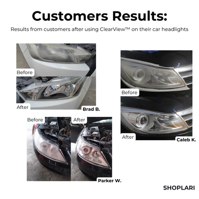 RadiantBeam™ — Instantly Clear Headlights for Safer, Stress-Free Night Driving