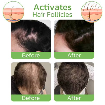 RevitaNest™ Hair Renewal Spray — Wake Up to Thicker, Stronger Hair Every Morning