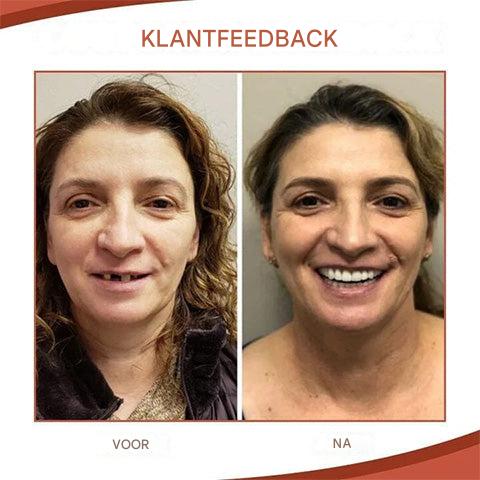 SilqueEase™ — Experience Pain-Free Denture Comfort That Lets You Smile with Confidence All Day